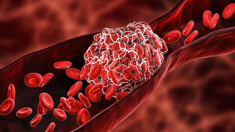 DNA-based drug to prevent blood clots
