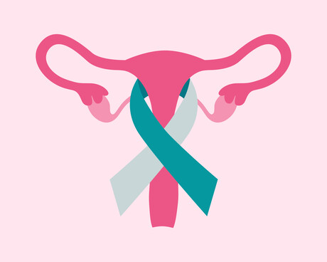 Novel test detects hard-to-find cervical cancers