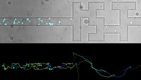 Immune cells move more independently than we thought