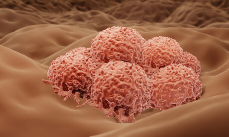 Screening platform identifies drugs to halt cancer spread Screening platform identifies drugs to halt cancer spread