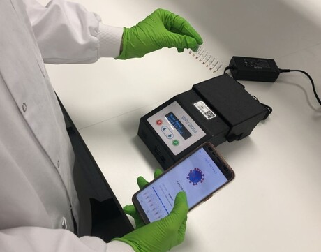 An AI-assisted diagnostic test for COVID and other diseases