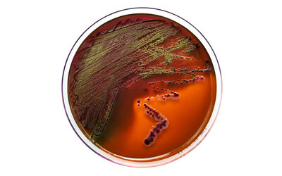 Researchers find the mutation that makes <em>E. coli</em> so dangerous