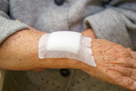 Key step uncovered in the wound healing process