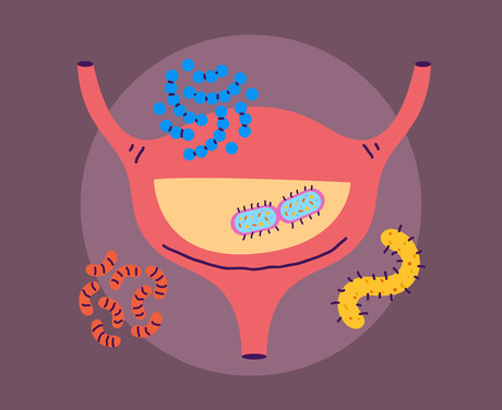 Oral UTI vaccine prevents infection for up to nine years Oral UTI vaccine prevents infection for up to nine years