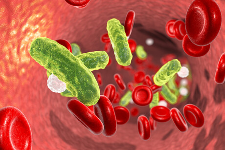 Two new methods for faster sepsis diagnosis