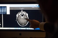 US case highlights dangers of fentanyl inhalation