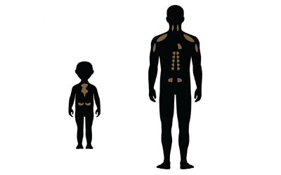 Researchers find the &#39;switch&#39; that deactivates brown fat