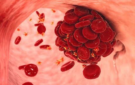 New anti-clotting agent has its own 'off switch' New anti-clotting agent has its own 'off switch'