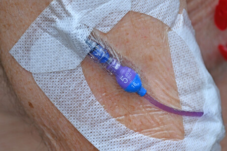 WHO releases guidelines for catheter-related infections WHO releases guidelines for catheter-related infections