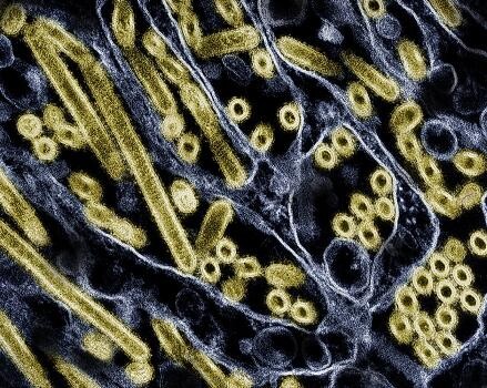 Bird flu update: raw milk risk, experimental vaccine developed