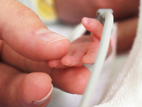 New guidelines to improve long-term care of preterm babies