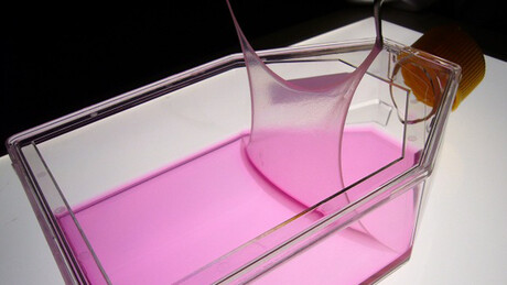 Treating rare skin diseases with transplants Treating rare skin diseases with transplants