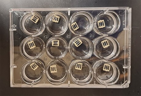 Lab-grown muscles reveal mysteries of rare genetic disorder