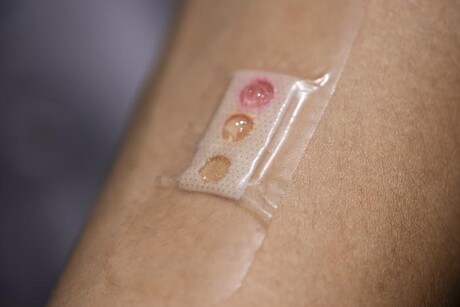 Wearable microlasers measure biomarkers in sweat Wearable microlasers measure biomarkers in sweat