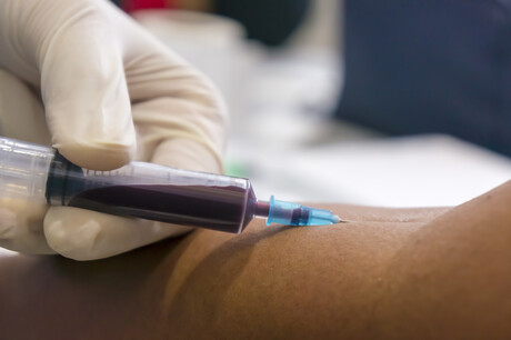 Liquid biopsy analysis helps improve cancer monitoring Liquid biopsy analysis helps improve cancer monitoring