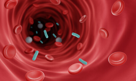 New method could lead to faster sepsis diagnosis New method could lead to faster sepsis diagnosis