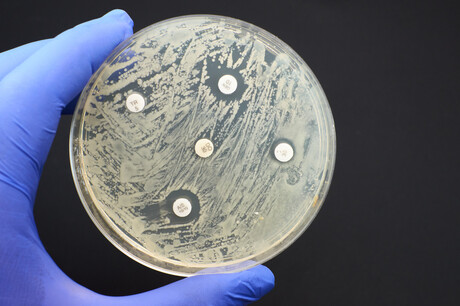 ARC training centre to tackle antimicrobial resistance ARC training centre to tackle antimicrobial resistance