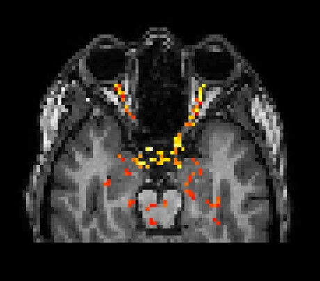 New functional brain imaging method identified