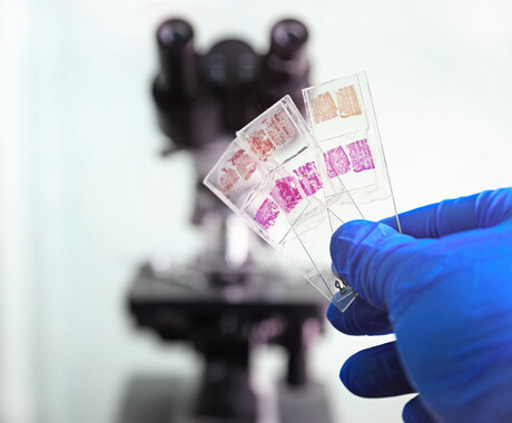 The need for quality assurance in histopathology laboratories