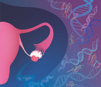 AI-based liquid biopsy could detect ovarian cancer earlier