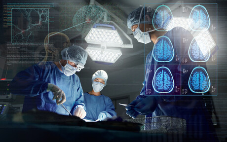 OCT system integrated into neurosurgical microscope