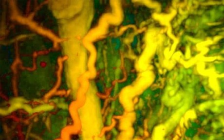 PAT imaging breakthrough could transform disease diagnosis PAT imaging breakthrough could transform disease diagnosis