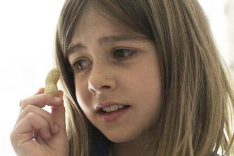 Mast cell test simplifies the diagnosis of food allergies Mast cell test simplifies the diagnosis of food allergies