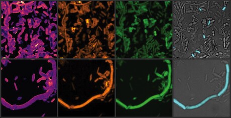 Parkinson&#39;s drug induces iron deficiency, disrupts gut microbiome