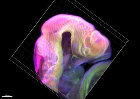 Fetuses can fight infections within the womb