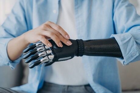 Artificial touch boosted by brain-controlled bionic hand Artificial touch boosted by brain-controlled bionic hand