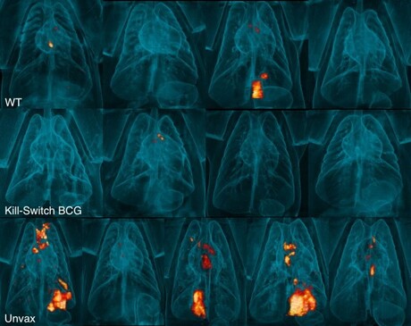 Self-destructing vaccine protects against TB in monkeys