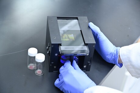 Development of at-home bladder cancer diagnostic kit