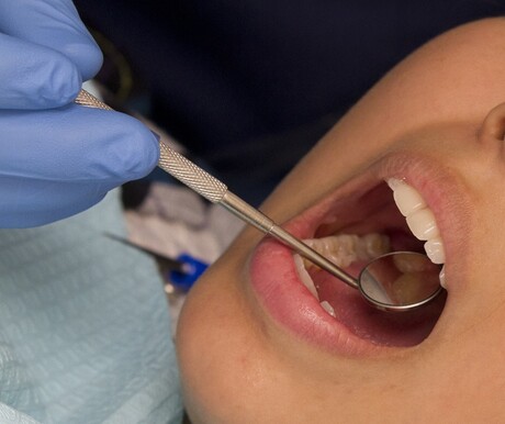 Common mouth and gut bacteria may increase stroke risk