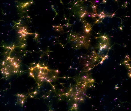 Human brain cells in a dish taught to play &#39;Pong&#39;