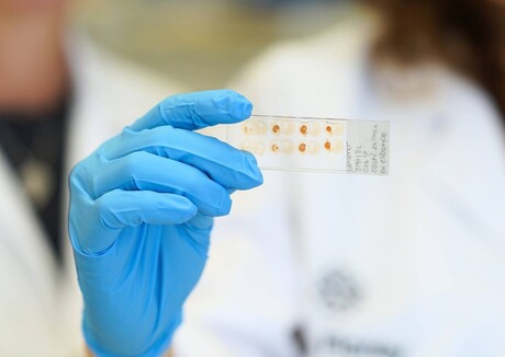 Preventing neural graft rejection in Parkinson&#39;s patients