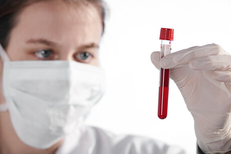 Early Parkinson&#39;s detection with an RNA-based blood test