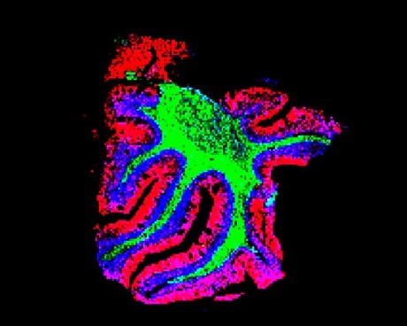 Breakthrough in imaging biomolecules inside cells