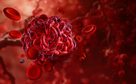 Real-time platelet monitoring helps better treat heart disease