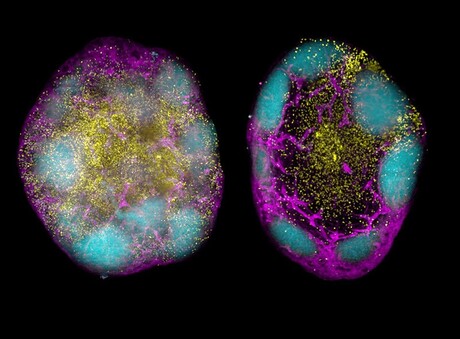 Immune cell boost could enable lasting vaccine protection