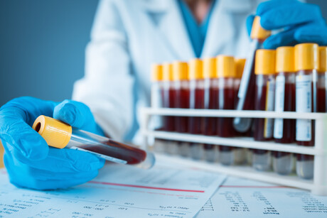 Why sample management should be every lab&#39;s first consideration