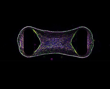 Cardiac organoids bring hope for treating heart disease