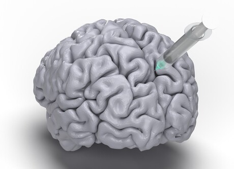 Ultrasound and imaging combined to map drug delivery into the brain