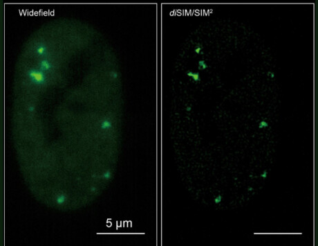 Gentle live-cell imaging at super resolution Gentle live-cell imaging at super resolution