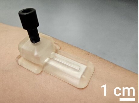 Self-powered patch for painless biomarker monitoring