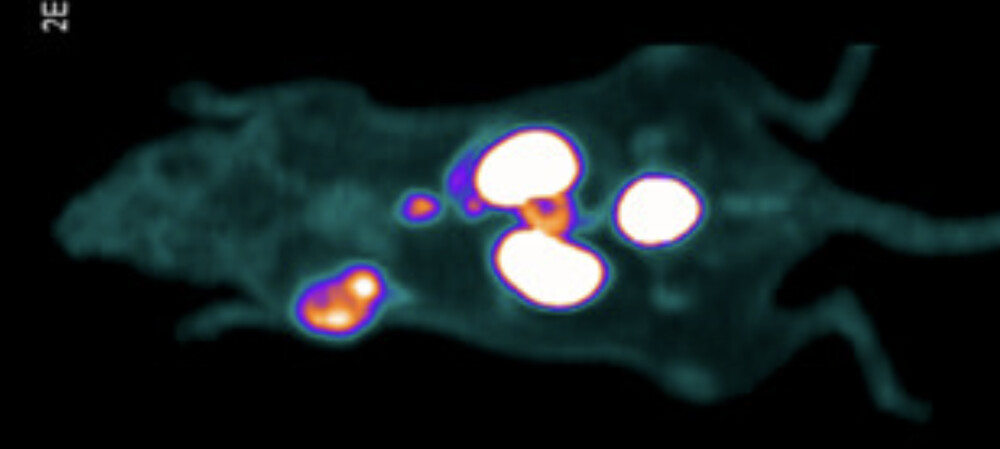 Could this tracer agent allow surgeons to see and &#39;hear&#39; prostate cancer?