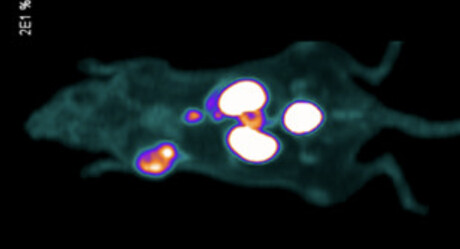 Could this tracer agent allow surgeons to see and &#39;hear&#39; prostate cancer?