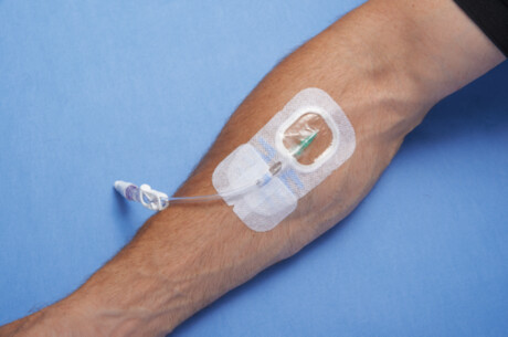 Integrated Securement Solutions: SorbaView SHIELD®
