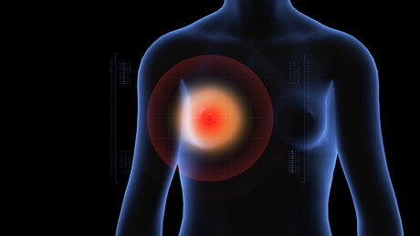 Beta blockers could halt triple negative breast cancer Beta blockers could halt triple negative breast cancer