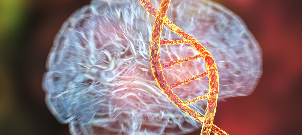 Gene therapy slows Huntington&#39;s disease progression in trial