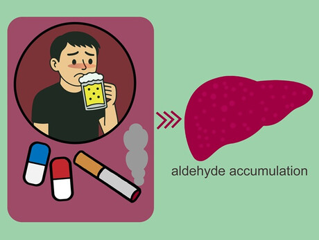 How a common gene mutation increases liver disease risk